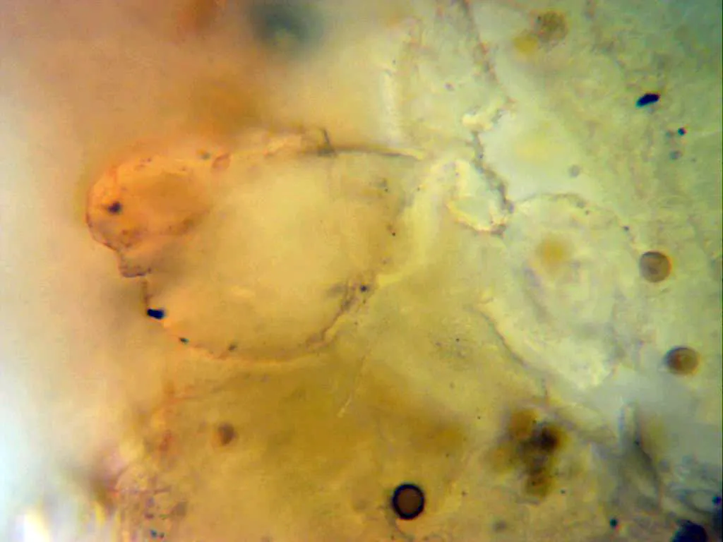 10 - Exoperidio cara interna